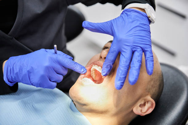 Best Emergency Wisdom Teeth Removal in Dalton, PA